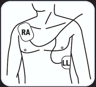 defibrillateur-progetti-6_314