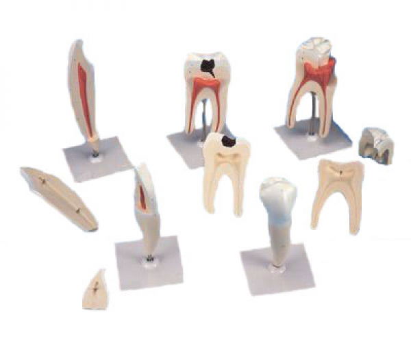 Série de 5 Modèles de Dents