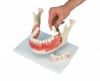 Cet article : Modèle d'affection dentaire, agrandissement : 2 fois, 21 pièces