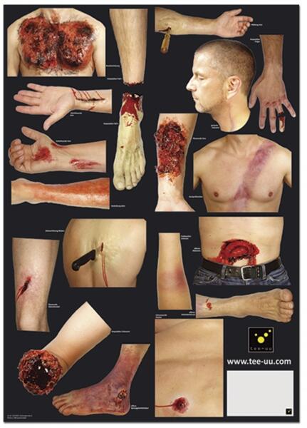 Kit de Simulation Blessures pour Mannequin de Dégagement CRASH & CARRY