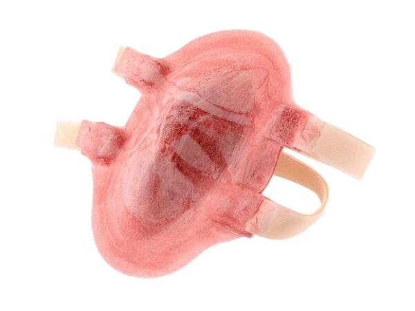 Fracture Fermée du Fémur Sur Filet