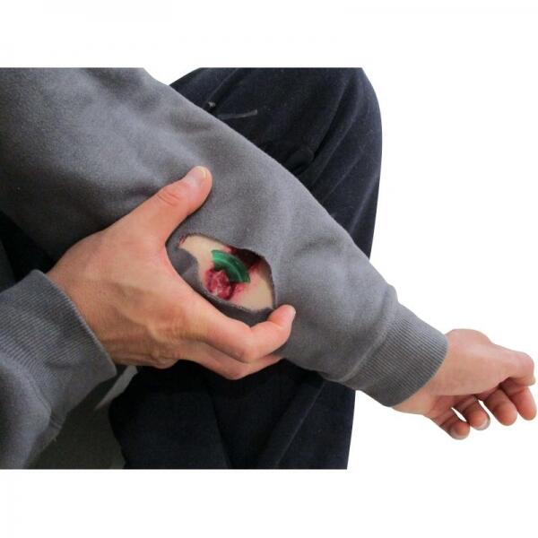 Plaie Filet avec Tesson