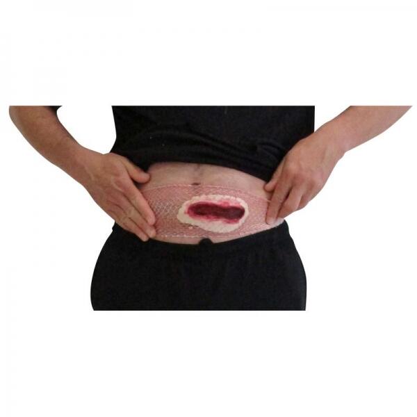 Plaie Coupure Abdominale Sur Filet
