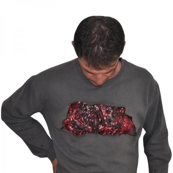 Simulateur Brûlure Thermique Thorax – Formation Secourisme Réaliste