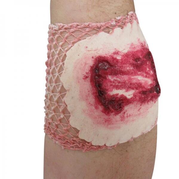 Plaie Filet Morsure de Chien