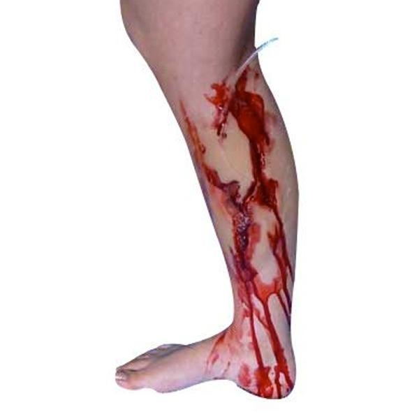 Prothèse de Plaie du Mollet