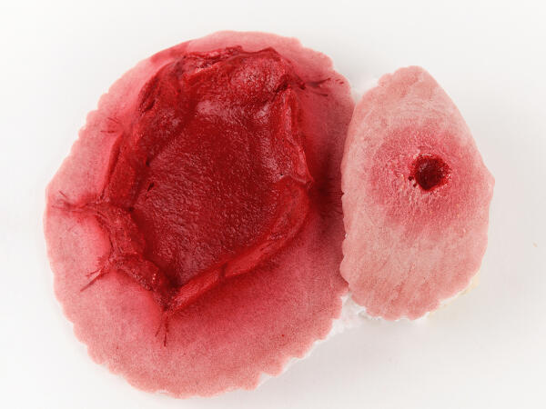 Plaie Filet Blessure Par Balle