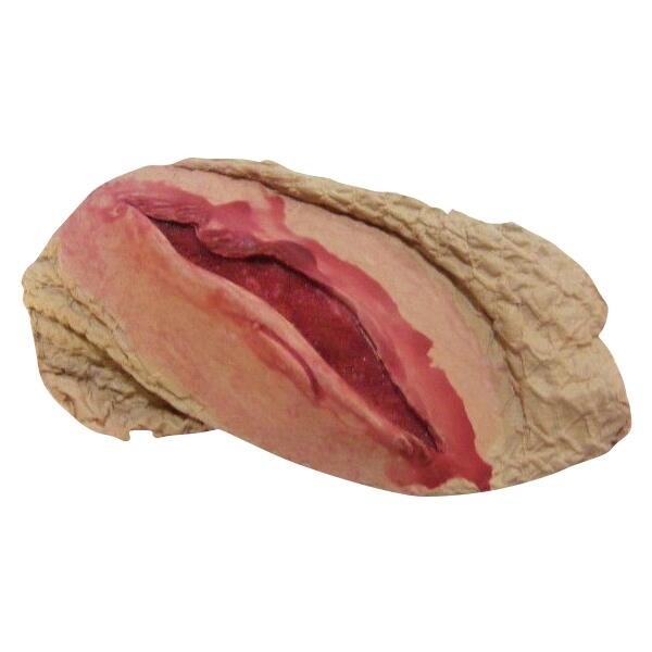 Plaie Filet à Bords Irréguliers