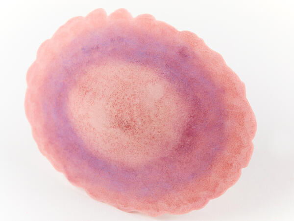 Plaie Filet Fracture Fermée