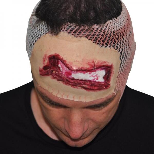 Plaie Grave Filet Scalp du Crâne