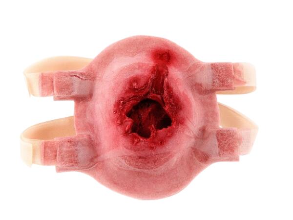 Plaie Filet Perforante pour Packing