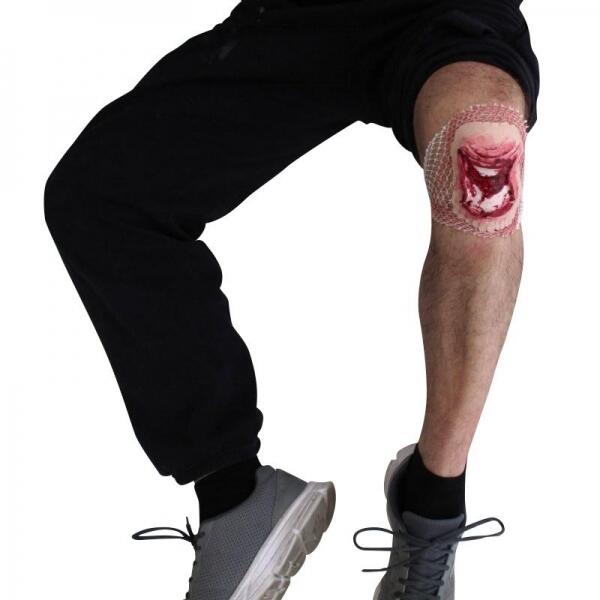 Plaie Filet Fracture Ouverte de la Rotule du Genou ou du Coude