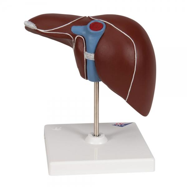 Foie avec Vésicule Biliaire